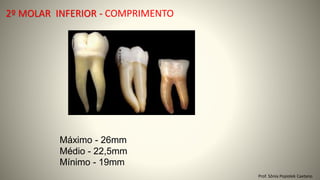 2º MOLAR INFERIOR - COMPRIMENTO
Prof. Sônia Popiolek Caetano
Máximo - 26mm
Médio - 22,5mm
Mínimo - 19mm
 