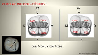 2º MOLAR INFERIOR - CÚSPIDES
Prof. Sônia Popiolek Caetano
CMV > CML > CDV > CDL
 