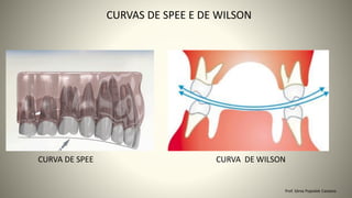 CURVAS DE SPEE E DE WILSON
Prof. Sônia Popiolek Caetano
CURVA DE SPEE CURVA DE WILSON
 