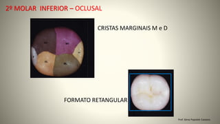 FORMATO RETANGULAR
Prof. Sônia Popiolek Caetano
2º MOLAR INFERIOR – OCLUSAL
CRISTAS MARGINAIS M e D
 