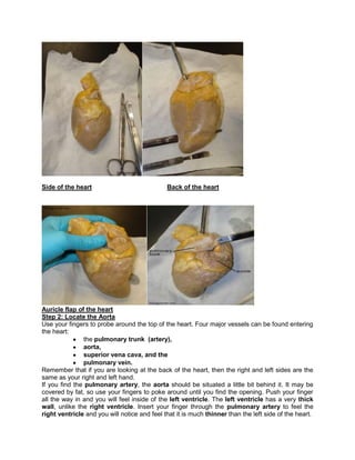Side of the heart Back of the heart
Auricle flap of the heart
Step 2: Locate the Aorta
Use your fingers to probe around the top of the heart. Four major vessels can be found entering
the heart:
the pulmonary trunk (artery),
aorta,
superior vena cava, and the
pulmonary vein.
Remember that if you are looking at the back of the heart, then the right and left sides are the
same as your right and left hand.
If you find the pulmonary artery, the aorta should be situated a little bit behind it. It may be
covered by fat, so use your fingers to poke around until you find the opening. Push your finger
all the way in and you will feel inside of the left ventricle. The left ventricle has a very thick
wall, unlike the right ventricle. Insert your finger through the pulmonary artery to feel the
right ventricle and you will notice and feel that it is much thinner than the left side of the heart.
 