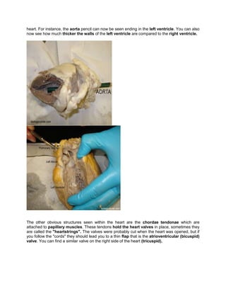 heart. For instance, the aorta pencil can now be seen ending in the left ventricle. You can also
now see how much thicker the walls of the left ventricle are compared to the right ventricle.
The other obvious structures seen within the heart are the chordae tendonae which are
attached to papillary muscles. These tendons hold the heart valves in place, sometimes they
are called the "heartstrings". The valves were probably cut when the heart was opened, but if
you follow the "cords" they should lead you to a thin flap that is the atrioventricular (bicuspid)
valve. You can find a similar valve on the right side of the heart (tricuspid).
 