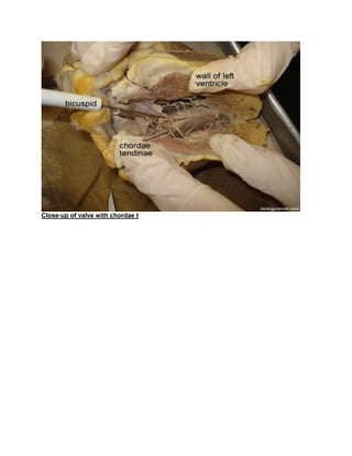 Close-up of valve with chordae t
 
