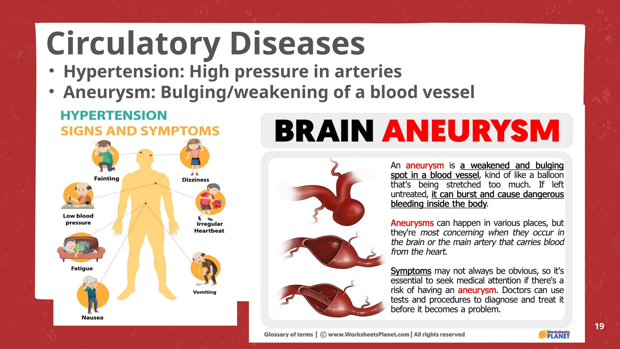 • Hypertension: High pressure in arteries
• Aneurysm: Bulging/weakening of a blood vessel
19
Circulatory Diseases
 