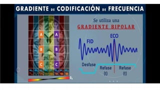 GRADIENTES EN RESONANCIA.pptx