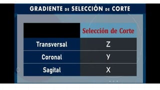 GRADIENTES EN RESONANCIA.pptx