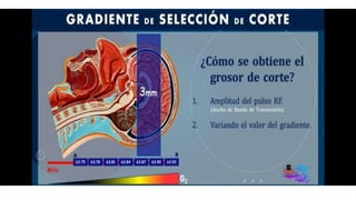 GRADIENTES EN RESONANCIA.pptx
