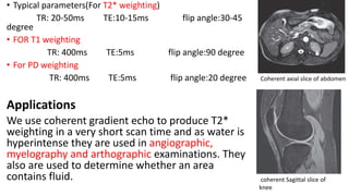 • Typical parameters(For T2* weighting)
TR: 20-50ms TE:10-15ms flip angle:30-45
degree
• FOR T1 weighting
TR: 400ms TE:5ms flip angle:90 degree
• For PD weighting
TR: 400ms TE:5ms flip angle:20 degree
Applications
We use coherent gradient echo to produce T2*
weighting in a very short scan time and as water is
hyperintense they are used in angiographic,
myelography and arthographic examinations. They
also are used to determine whether an area
contains fluid.
Coherent axial slice of abdomen
coherent Sagittal slice of
knee
 