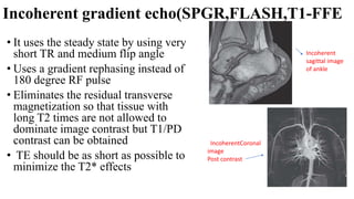 Incoherent gradient echo(SPGR,FLASH,T1-FFE
• It uses the steady state by using very
short TR and medium flip angle
• Uses a gradient rephasing instead of
180 degree RF pulse
• Eliminates the residual transverse
magnetization so that tissue with
long T2 times are not allowed to
dominate image contrast but T1/PD
contrast can be obtained
• TE should be as short as possible to
minimize the T2* effects
Incoherent
sagittal image
of ankle
IncoherentCoronal
image
Post contrast
 