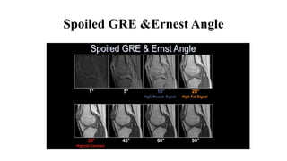 Spoiled GRE &Ernest Angle
 