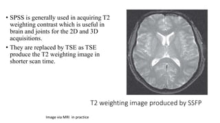 T2 weighting image produced by SSFP
• SPSS is generally used in acquiring T2
weighting contrast which is useful in
brain and joints for the 2D and 3D
acquisitions.
• They are replaced by TSE as TSE
produce the T2 weighting image in
shorter scan time.
Image via MRI in practice
 