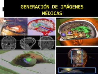 GENERACIÓN DE IMÁGENES MÉDICAS