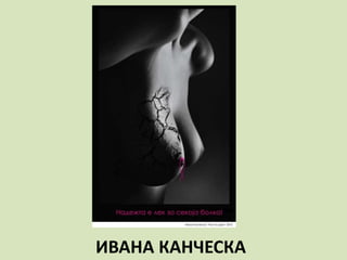 ИВАНА КАНЧЕСКА
 