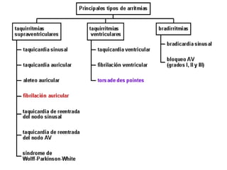Gralidades de arritmias