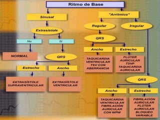 Gralidades de arritmias