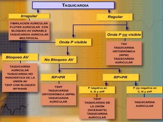 Gralidades de arritmias