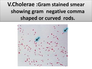 practical microbiology Gram staining | PDF