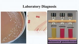 Laboratory Diagnosis
 