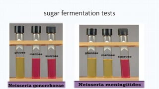 sugar fermentation tests
 