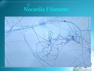 Nocardia Filaments
 