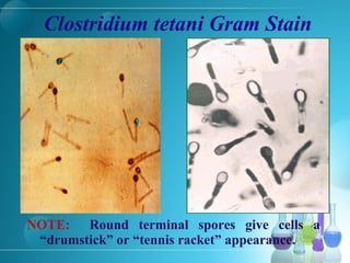Clostridium tetani Gram Stain
NOTE: Round terminal spores give cells a
“drumstick” or “tennis racket” appearance.
 
