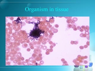 Organism in tissue
 