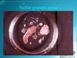 Sulfur granule gross
 