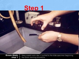 Step 1
Dr.T.V.Rao MD 18
 