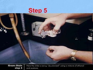 Step 5
Dr.T.V.Rao MD 22
 