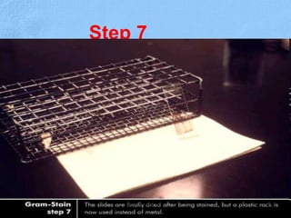 Step 7
Dr.T.V.Rao MD 26
 