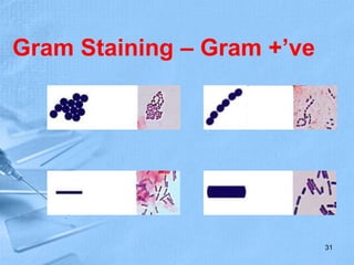 Gram Staining – Gram +’ve
31
 