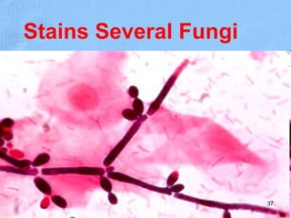 Stains Several Fungi
37
 