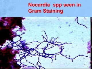 Nocardia spp seen in
Gram Staining
41
 
