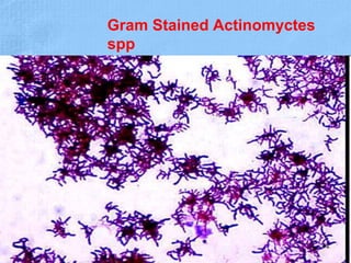 Gram Stained Actinomyctes
spp
42
 