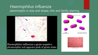 Haemophilus influenza
pleomorphic in size and shape, thin and faintly staining
 