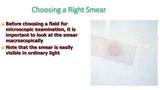 Choosing a Right Smear
 Before choosing a field for
microscopic examination, it is
important to look at the smear
macroscopically
 Note that the smear is easily
visible in ordinary light
 