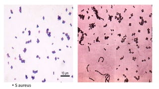 • S aureus
 