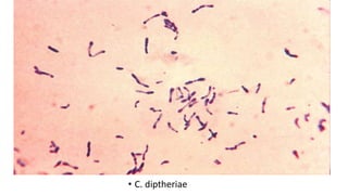 • C. diptheriae
 