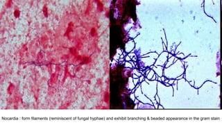 Nocardia : form filaments (reminiscent of fungal hyphae) and exhibit branching & beaded appearance in the gram stain
 