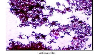 • Actinomycetes
 