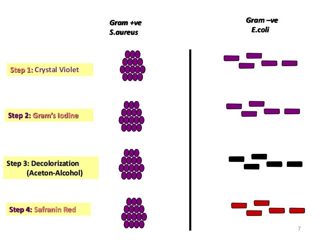 Gram Staining Miceobiology Student
