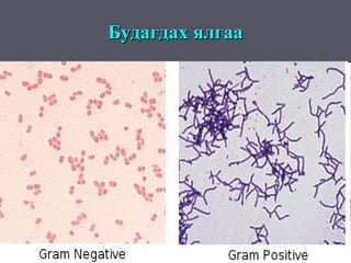 Будагдах ялгаа
 