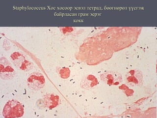 Staphylococcus Хос хосоор эсвэл тетрад, бөөгнөрөл үүсгэж
                 байрласан грам эерэг
                          кокк
 