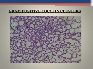 GRAM POSITIVE COCCI IN CLUSTERS
 