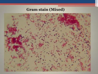 Gram stain (Mixed)
 