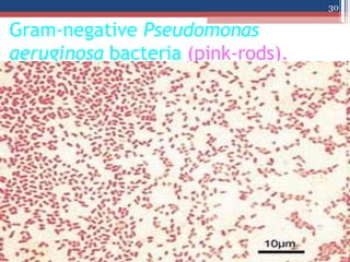 Gram-negative Pseudomonas
aeruginosa bacteria (pink-rods).
30
 