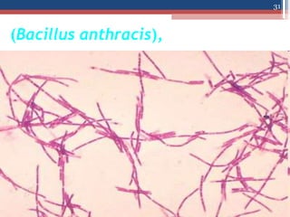 (Bacillus anthracis),
31
 