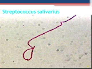Streptococcus salivarius
 