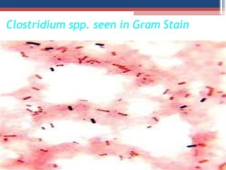 Clostridium spp. seen in Gram Stain
 