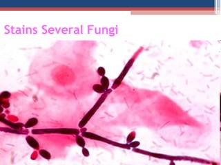 Stains Several Fungi
 